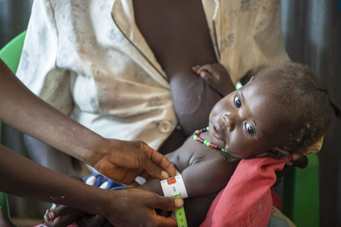 Campaña Contra La Desnutrición En Sudán Del Sur Unicef 6421