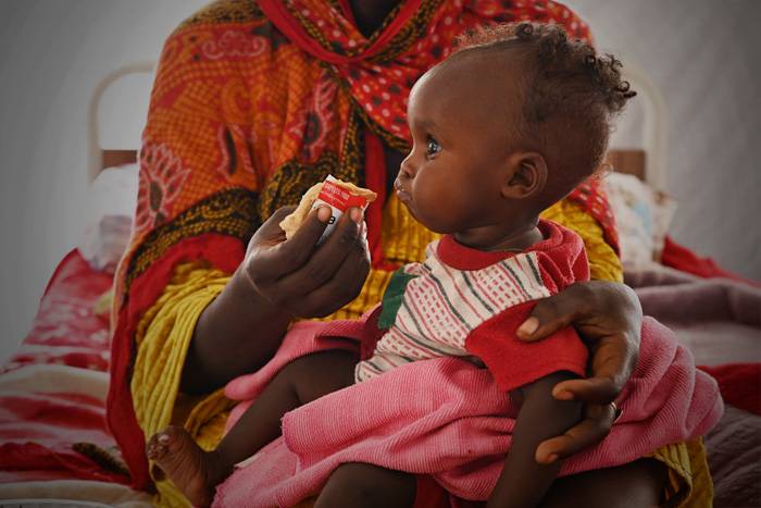 UNICEF - Desnutrición infantil Una bebé con un sobre de alimento