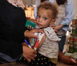 Niños vulnerables reciben apoyo nutricional en un punto de detección y tratamiento de desnutrición apoyado por UNICEF en Khan Yunis, en el sur de la Franja de Gaza. Alimento terapéutico